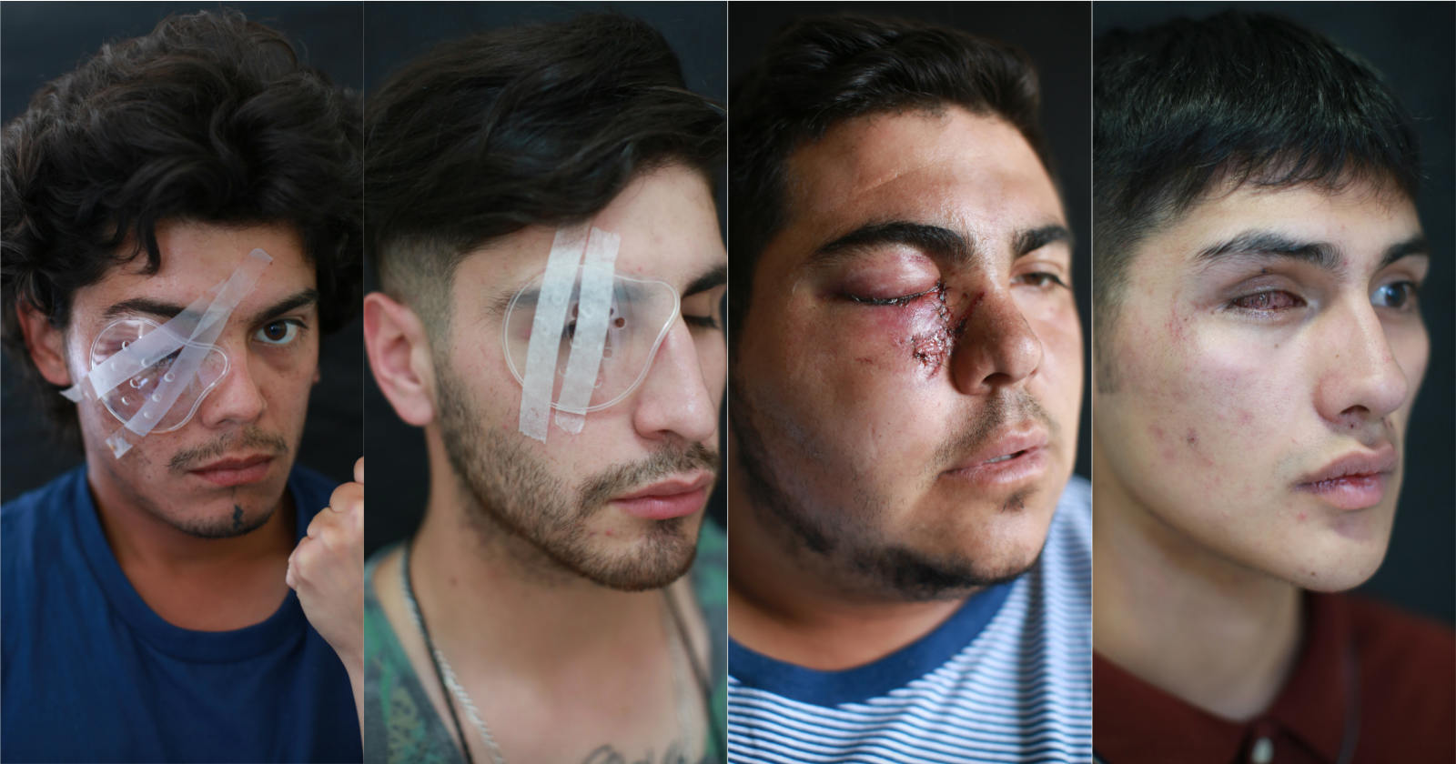 Luis Sergio heridos oculares