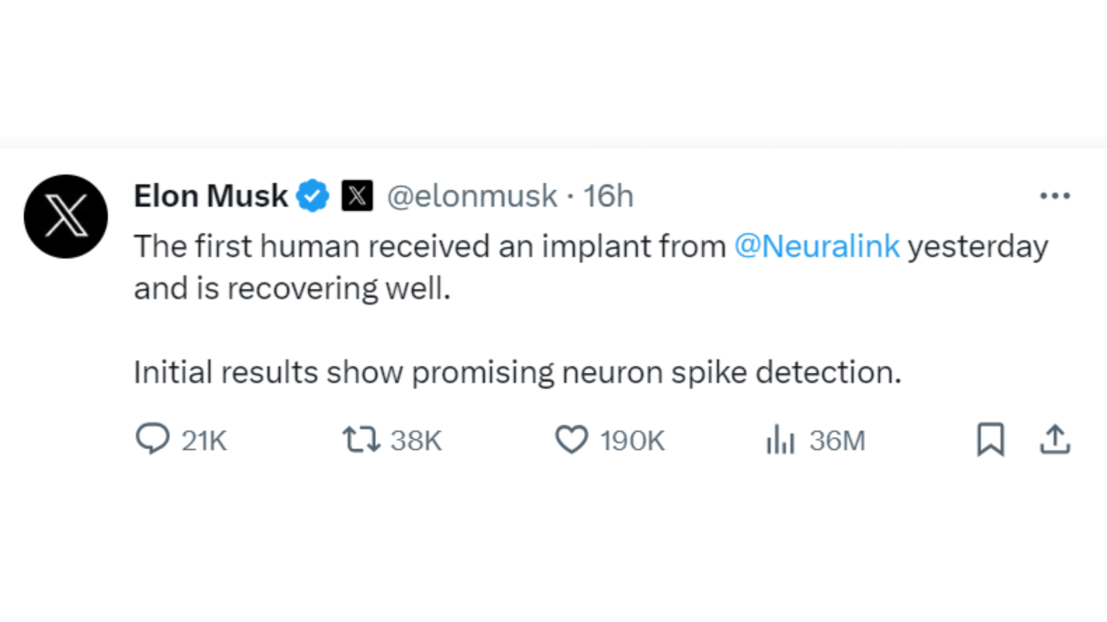 Chip cerebral, tweet de Elon Musk 