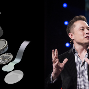 Chip cerebral de Elon Musk ya fue implantado en una persona