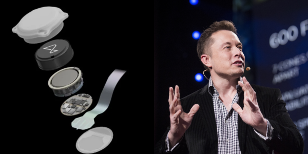 Chip cerebral de Elon Musk ya fue implantado en una persona